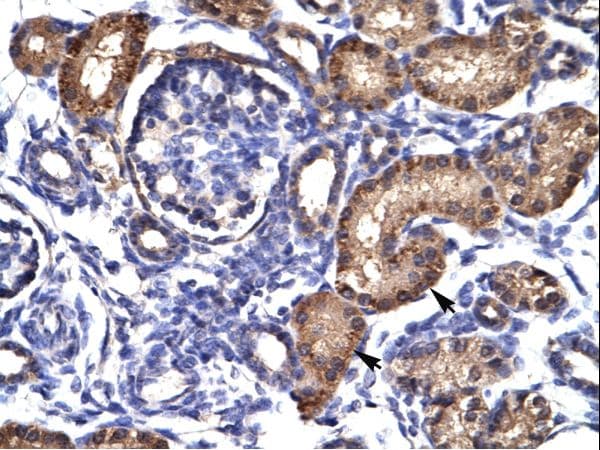 AHR Antibody (aa78-127)