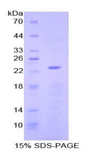 Mouse NME3 Protein (Recombinant His-T7)