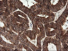 TAPBPL / TAPBPR Antibody (clone OTI4H5)