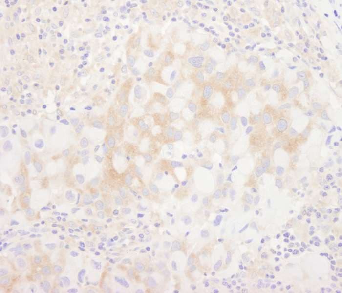 BRUCE / BIRC6 Antibody (aa4775-C-term)
