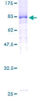 Human FBXW11 Protein (Recombinant GST)