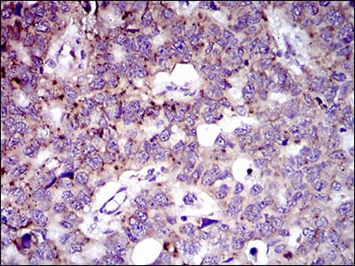 Monoclonal Mouse anti-Human MRPL42 / MRPS32 Antibody (clone 3H6H2, aa10-142, IHC, WB)