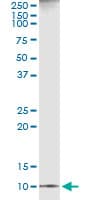 IHC-plus™ CXCL11 Antibody (clone 3C1)