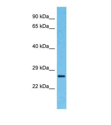 ETS1 / ETS-1 Antibody (aa95-144)