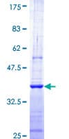 Human CNOT7 Protein (Recombinant GST, N-terminus)