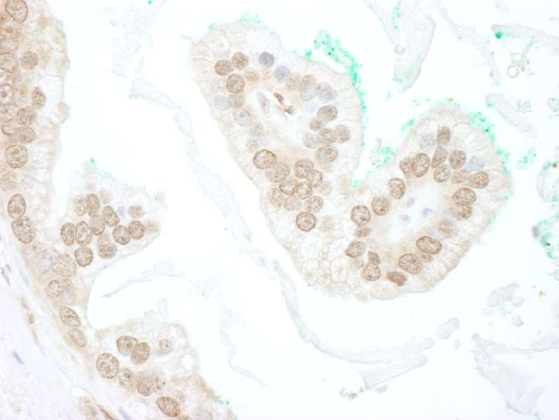 SLX4 Antibody (aa1784-1834)