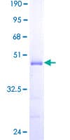 Human CABP4 Protein (Recombinant GST)