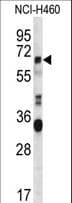 ERVFRD-1 / HERV-FRD Antibody (aa79-107)