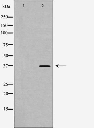 CD1D Antibody