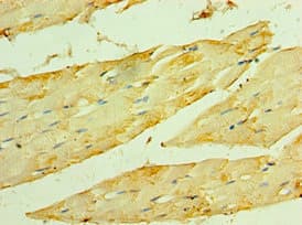 Polyclonal Rabbit anti-Human HSPB2 / HSP27 Antibody (aa1-182, IHC)