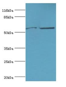 CYP2E1 Antibody (aa49-288)