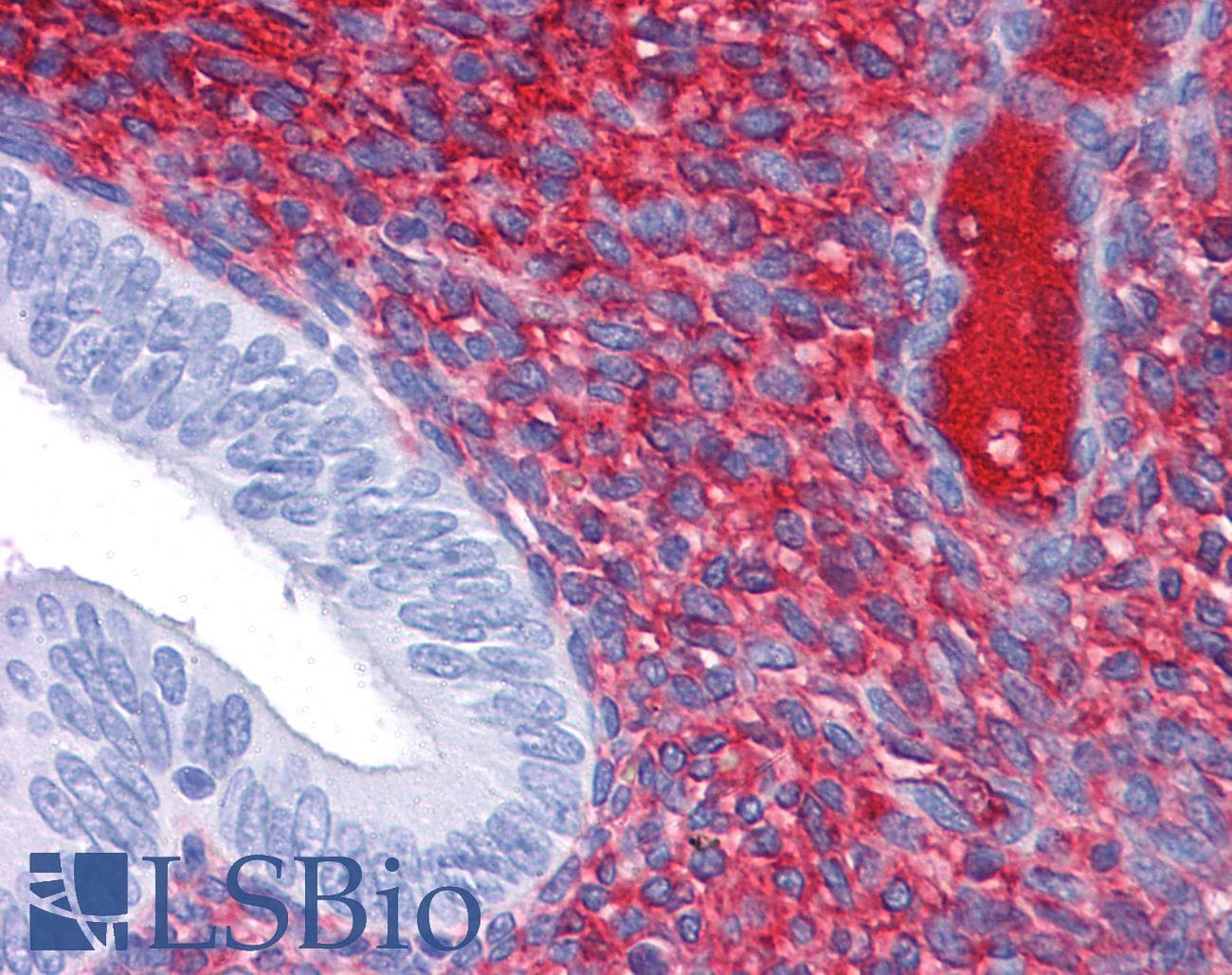 IHC-plus™ Monoclonal Mouse anti-Human CDH18 / Ey-Cadherin Antibody (clone 6F7, IHC, WB)