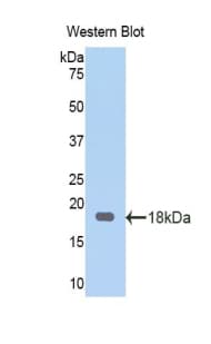 SERPINA6 / CBG Antibody (aa280-405, APC)