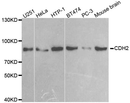 IHC-plus™ CDH2 / N Cadherin Antibody