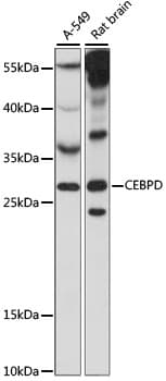 Polyclonal Rabbit anti-Human C/EBP Delta / CEBPD Antibody (WB)