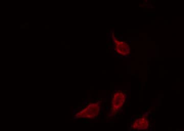 Polyclonal Rabbit anti-Human EIF3L / EIF3EIP Antibody (IF, WB)