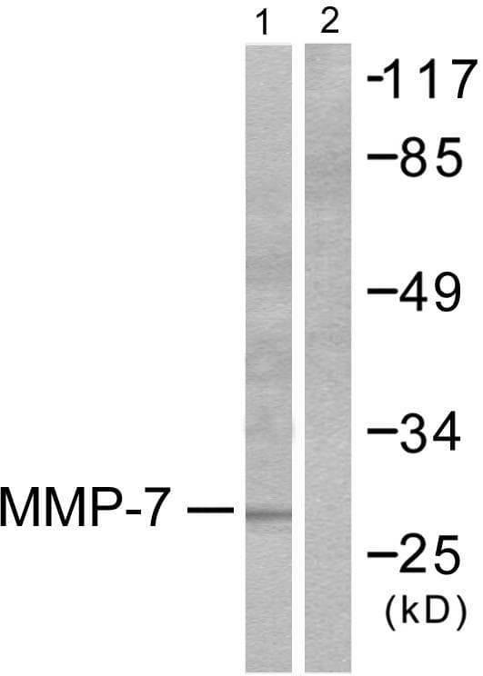 Polyclonal Rabbit anti-Human MMP7 / Matrilysin Antibody (IHC, WB)