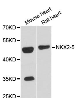 Polyclonal Rabbit anti-Human NKX2-5 Antibody (WB)