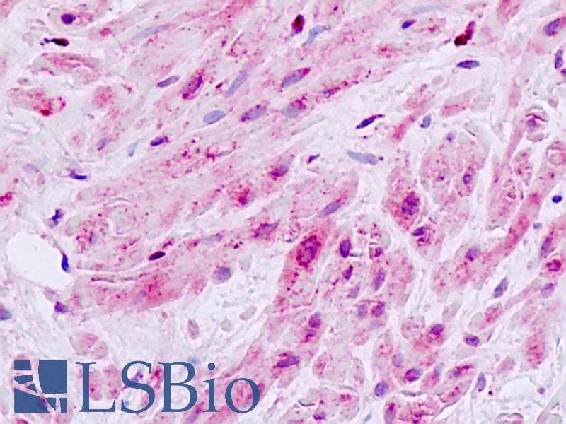 IHC-plus™ MAP3K9 / MLK1 Antibody (Internal)