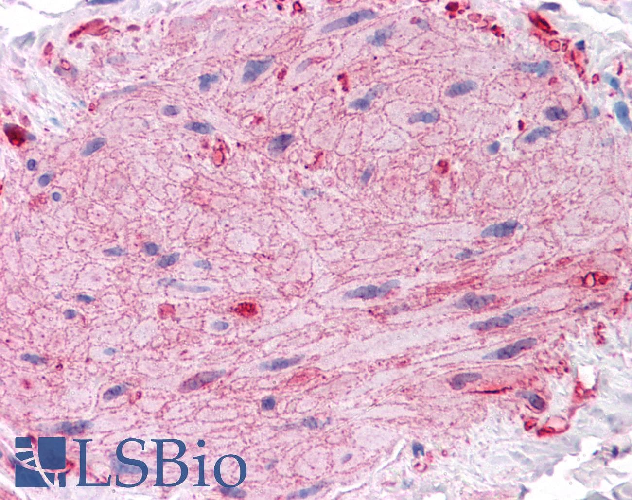 IHC-plus™ VCL / Vinculin Antibody