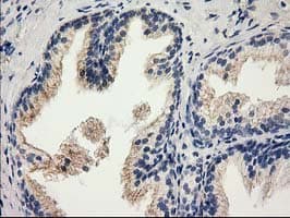 CAT / Catalase Antibody (clone OTI3C3)