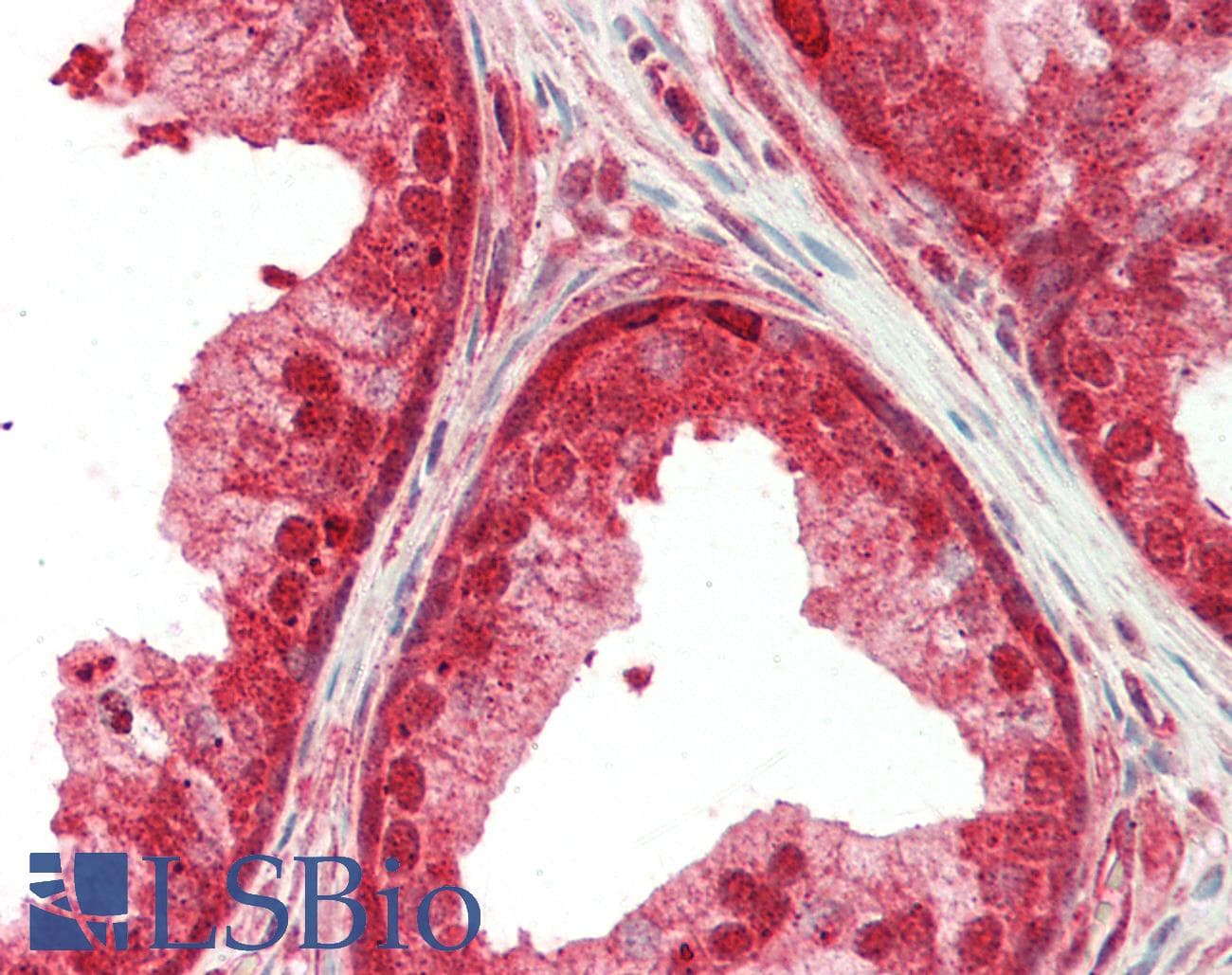 IHC-plus™ Polyclonal Rabbit anti-Human SEMA4D / Semaphorin 4D / CD100 Antibody (aa812-862, IHC, WB)