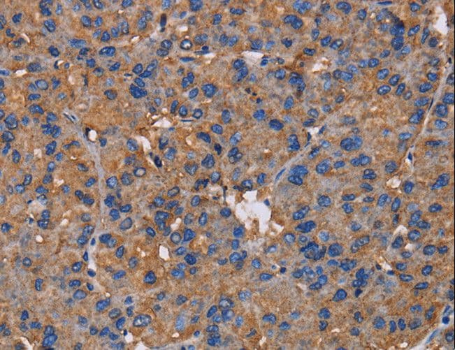 Polyclonal Rabbit anti-Human NCSTN / Nicastrin Antibody (IHC)
