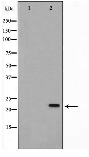 Polyclonal Rabbit anti-Human NME1 / NM23 Antibody (WB)