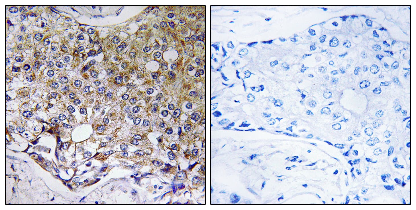 ATG4A Antibody (aa81-130)