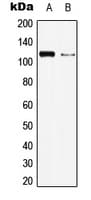 Polyclonal Rabbit anti-Human BMPR2 Antibody (N-Terminus, WB)