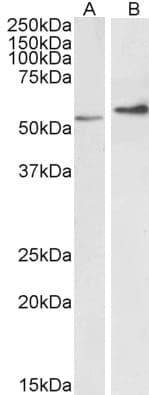 PathPlus™ Vimentin Antibody