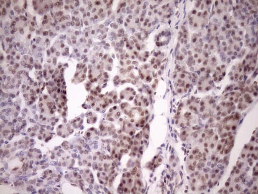 Monoclonal Mouse anti-Human WTAP Antibody (clone OTI12G6, Carrier-free, aa2-106, IHC, WB)
