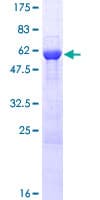 Human PIM2 / Pim-2 Protein (Recombinant GST)