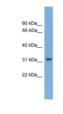 CRLF2 / TSLPR Antibody (aa71-120, Biotin)