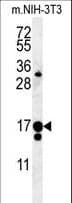 Polyclonal Rabbit anti-Human IFT43 / C14orf179 Antibody (aa145-171, IHC, WB)