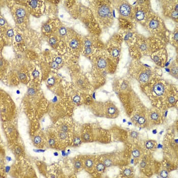 Polyclonal Rabbit anti-Human MYO1C Antibody (IHC, IF, WB)