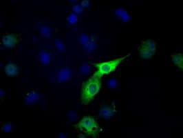 IHC-plus™ LTA4H / LTA4 Antibody (clone 9G8)