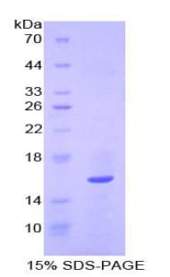 Human QSOX1 / QSCN6 Protein (Recombinant His)