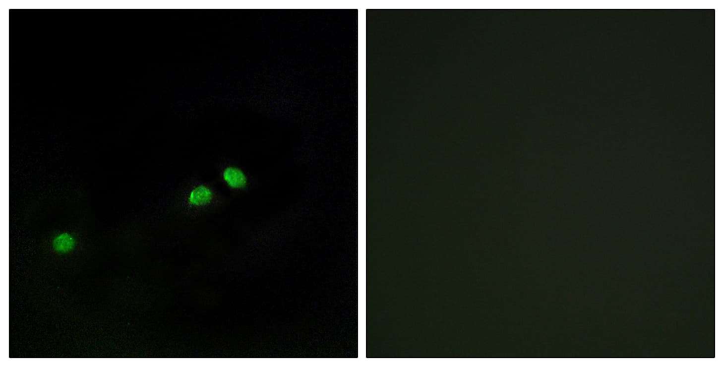 CENPA / CENP-A Antibody (phospho-Ser7)