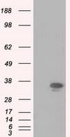 PIM2 / Pim-2 Antibody (clone OTI5D5)