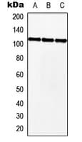 MKL2 Antibody (Internal)