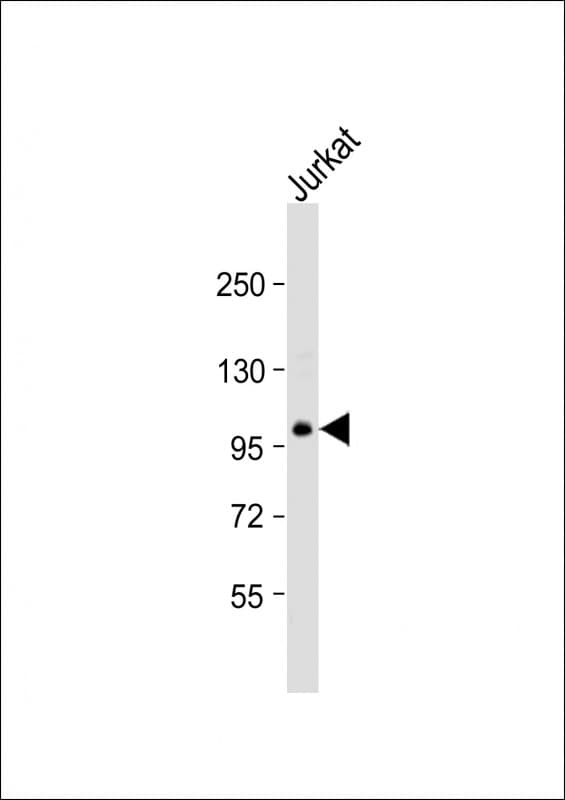 TSC22D1 / TSC22 Antibody (aa888-920)