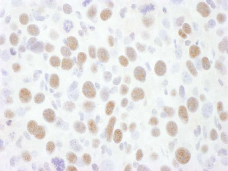 CDK9 Antibody (aa322-372)