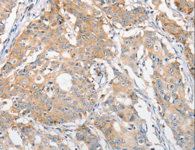 APOBEC3G / CEM15 Antibody
