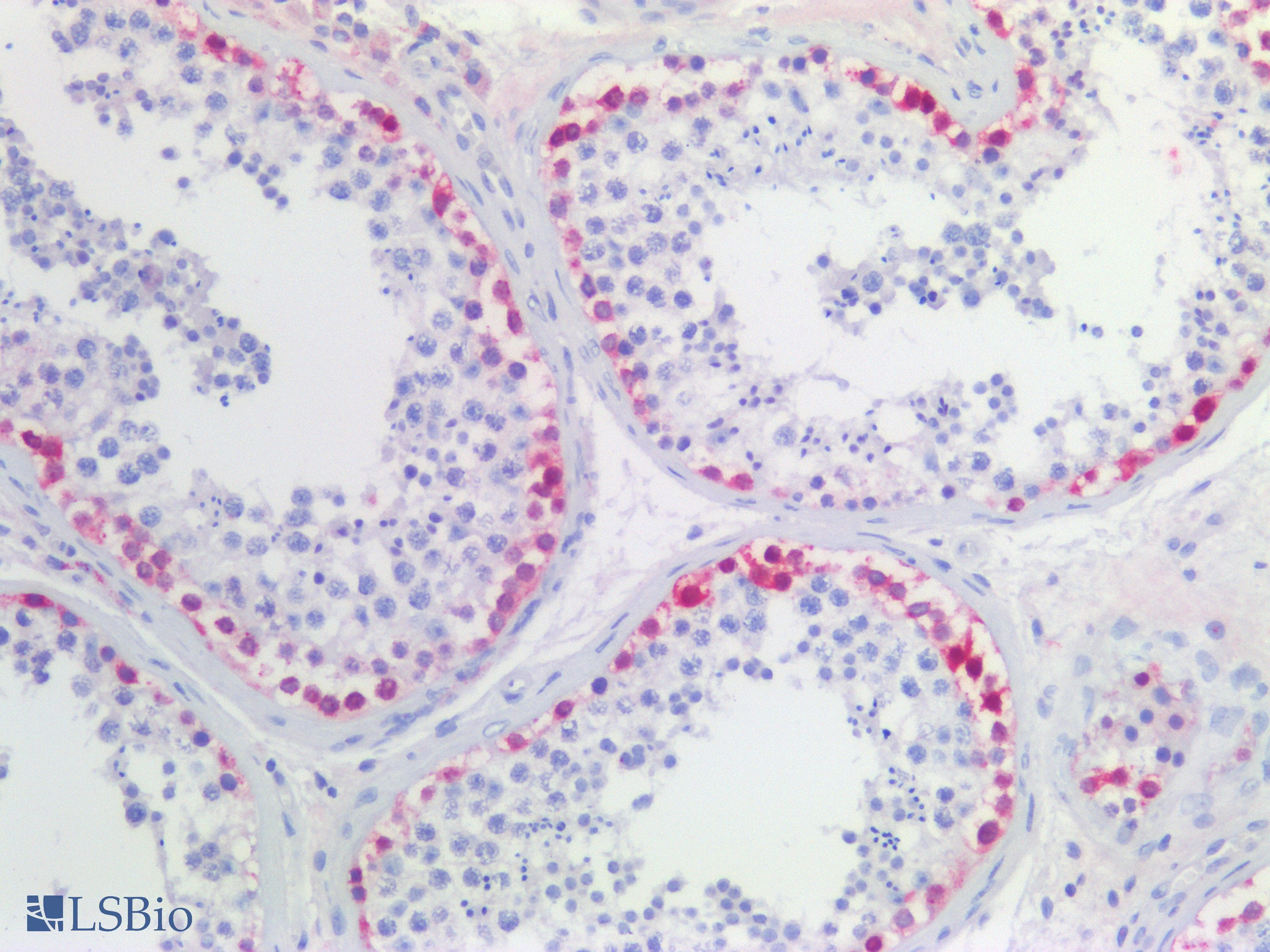 PathPlus™ ELAVL2 / HUB Antibody