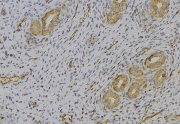 Polyclonal Rabbit anti-Human KLK2 / Kallikrein 2 Antibody (IHC, WB)
