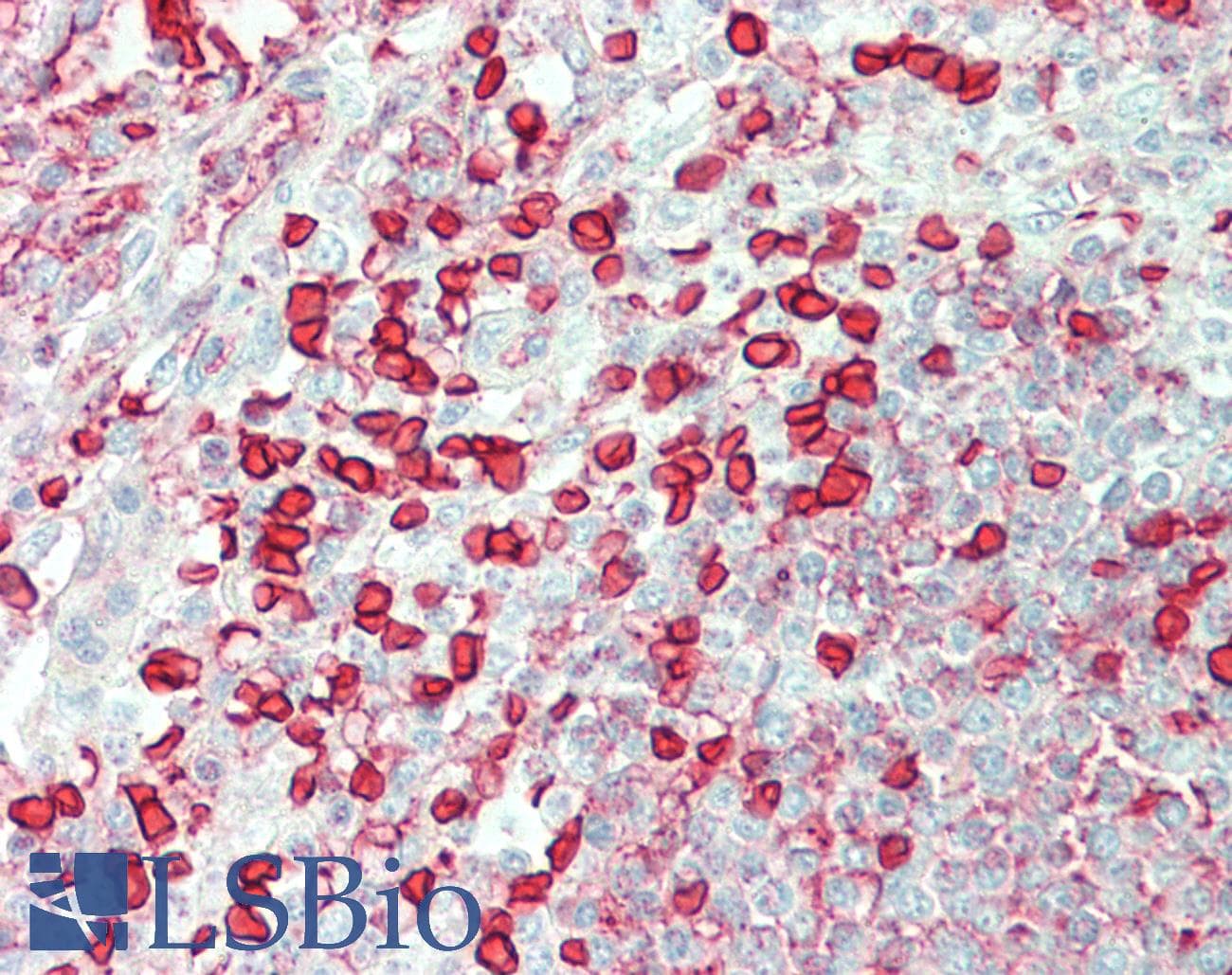 IHC-plus™ CA1 / Carbonic Anhydrase I Antibody (Lyophilized)