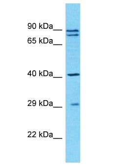 Polyclonal Rabbit anti-Human TUBAL3 Antibody (aa89-138, WB)