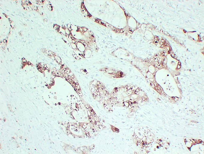 S100P Antibody (clone ABT-S100P)