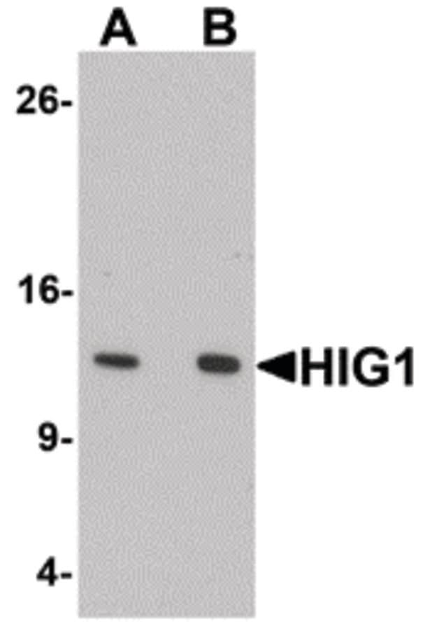 Polyclonal Rabbit anti-Human HIGD1A Antibody (IF, WB)